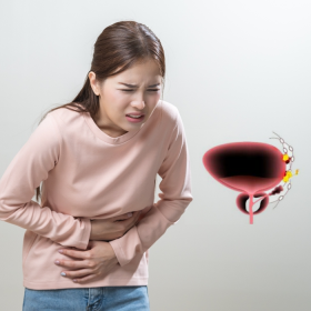 Giải đáp chi tiết các giai đoạn của ung thư bàng quang từ sớm đến muộn