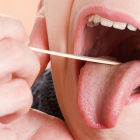 Chẩn đoán ung thư lưỡi sớm bằng cách nào? Những điều cần biết