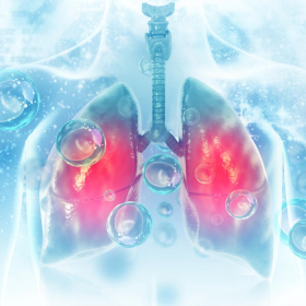 Tìm hiểu về chi phí điều trị ung thư phổi hiên nay bao nhiêu?