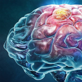 Tổng hợp chi phí hóa trị ung thư não và những lưu ý quan trọng