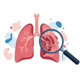 Có mấy loại ung thư phổi phổ biến thường gặp hiện nay?