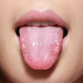 Đau rát lưỡi là bệnh gì? Nguyên nhân và cách điều trị hiệu quả