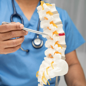 Phác đồ điều trị ung thư tủy sống hiện nay