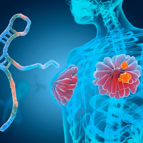 Liệu pháp nội tiết trong điều trị ung thư vú: Chỉ định, mục tiêu và các lưu ý