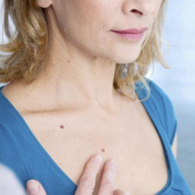 Xuất hiện nốt ruồi ở ngực có phải ung thư vú không?