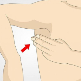 Triệu chứng ung thư vú thường gặp mà nhiều người bỏ qua