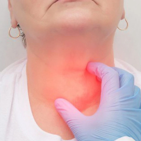 U lympho là gì? Nguyên nhân, triệu chứng và chẩn đoán