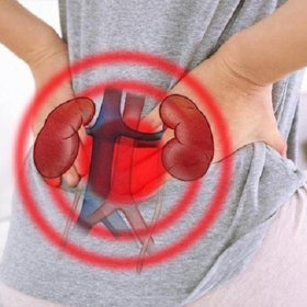 Ung thư biểu mô tế bào thận​: Nguyên nhân, dấu hiệu và phòng bệnh