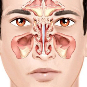 Ung thư mũi: Triệu chứng, nguyên nhân và cách phòng ngừa