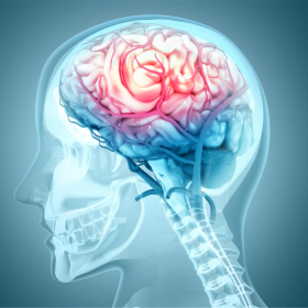 Ung thư phổi di căn não: Những điều bệnh nhân và gia đình cần biết