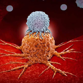 Ung thư tuyến giáp di căn phổi: Triệu chứng và cách phòng bệnh