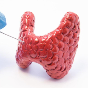 Giải đáp: Ung thư tuyến giáp thể nhú có nguy hiểm không?