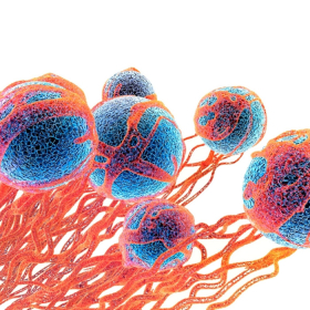 Ung thư vú di căn xương: Dấu hiệu, tiên lượng sống và cách xử lý