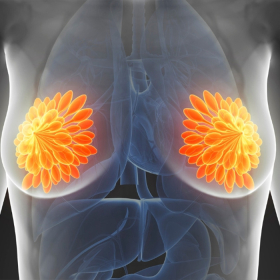 Người bị ung thư vú di căn xương sống được bao lâu?