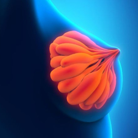 Ung thư vú giai đoạn 3: Triệu chứng, phương pháp điều trị và cơ hội sống