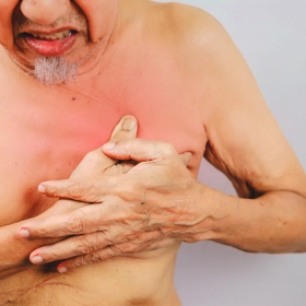 Ung thư vú ở nam giới: Nguyên nhân, dấu hiệu, chẩn đoán và phòng ngừa