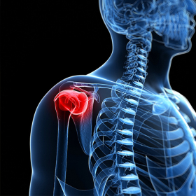 Ung thư xương là gì? Nguyên nhân, triệu chứng và cách điều trị