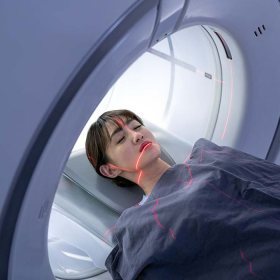 Xạ trị ung thư cổ tử cung là gì? Tác dụng phụ và các lưu ý khi xạ trị