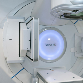 Xạ trị ung thư phổi bao nhiêu tiền​? Khi nào cần thực hiện xạ trị?