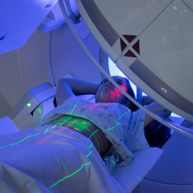 Xạ trị ung thư vú là gì? Đối tượng, quy trình và phương pháp điều trị