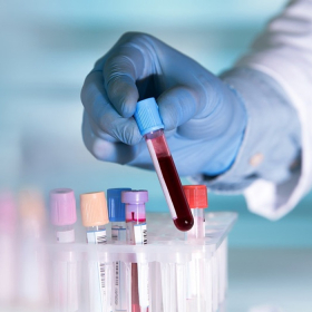 Xét nghiệm ung thư não gồm những gì? Quy trình và chi phí