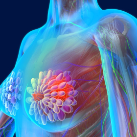 Xơ nang tuyến vú: Biến chứng, nguyên nhân và độ nguy hiểm